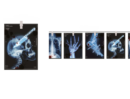 GIRLANDA ZE ZDJĘCIAMI X-RAY 300 CM