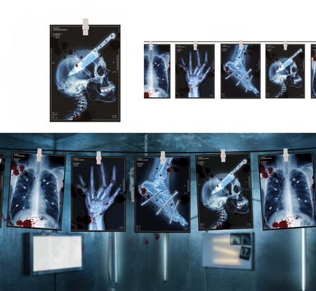 GIRLANDA ZE ZDJĘCIAMI X-RAY 300 CM