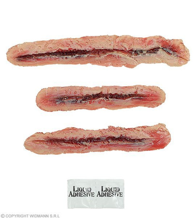 ZESTAW RAN 3 SZNYTY+KLEJ