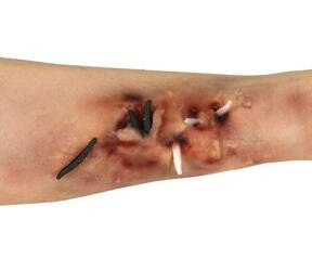 SZTUCZNA RANA ROBAKI