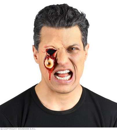 RANA WYPŁYWAJĄCE OKO