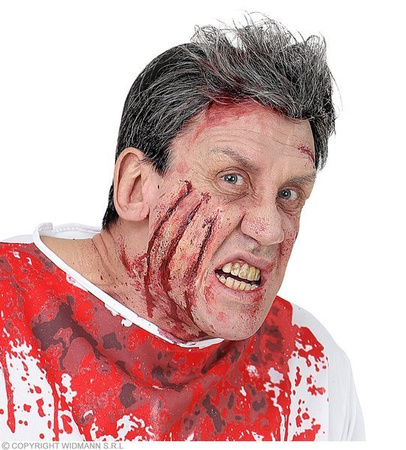 ZESTAW RAN 3 SZNYTY+KLEJ