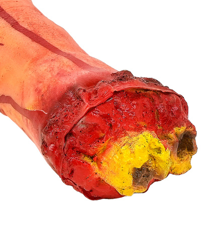 ODCIĘTA KRWAWA DŁOŃ