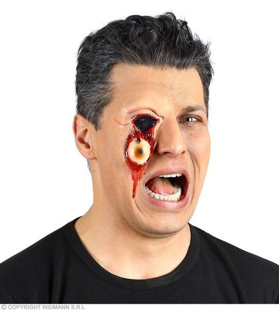 RANA WYPŁYWAJĄCE OKO