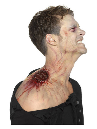 RANA OTWARTA ZAKAŻONA POPARZENIE